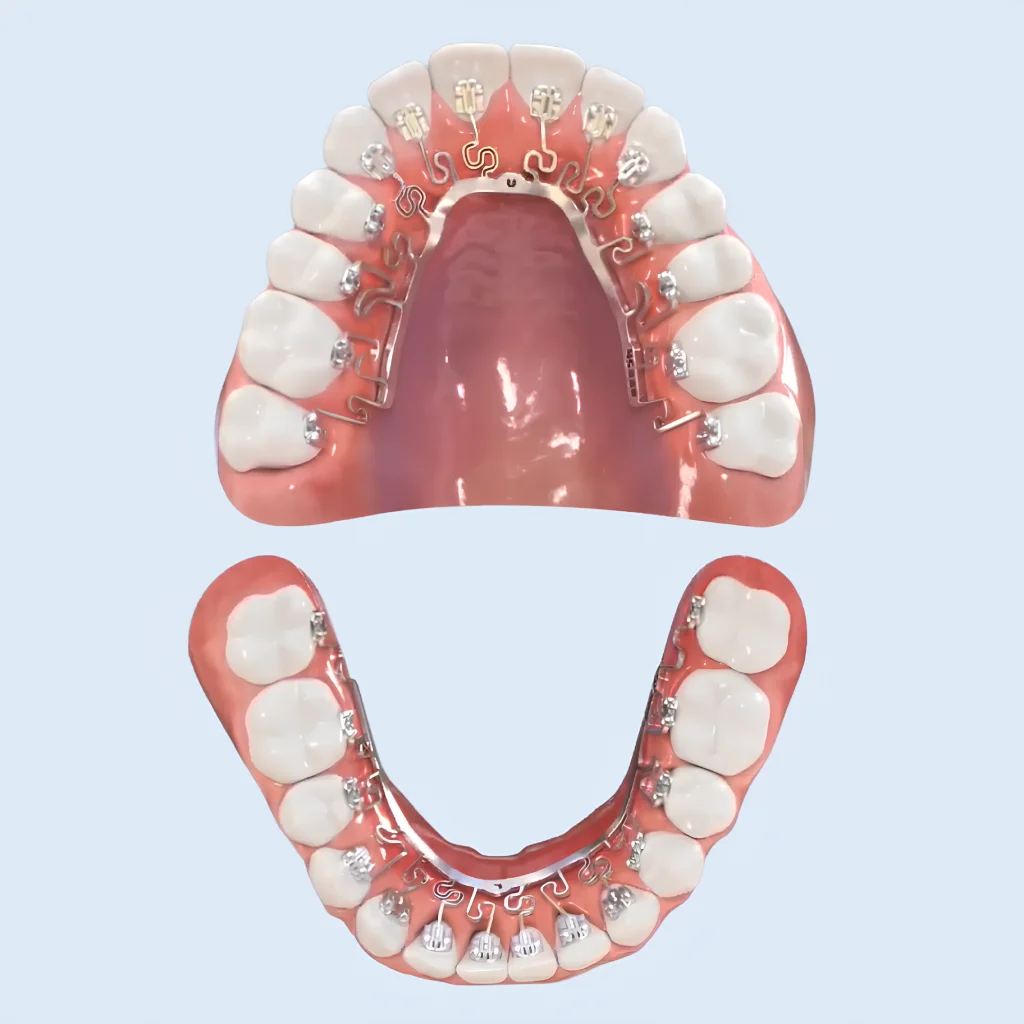 จัดฟัน Brava