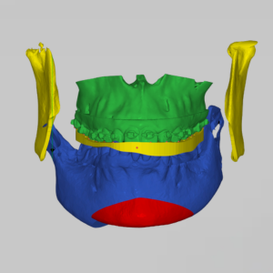 จัดฟันร่วมผ่า
