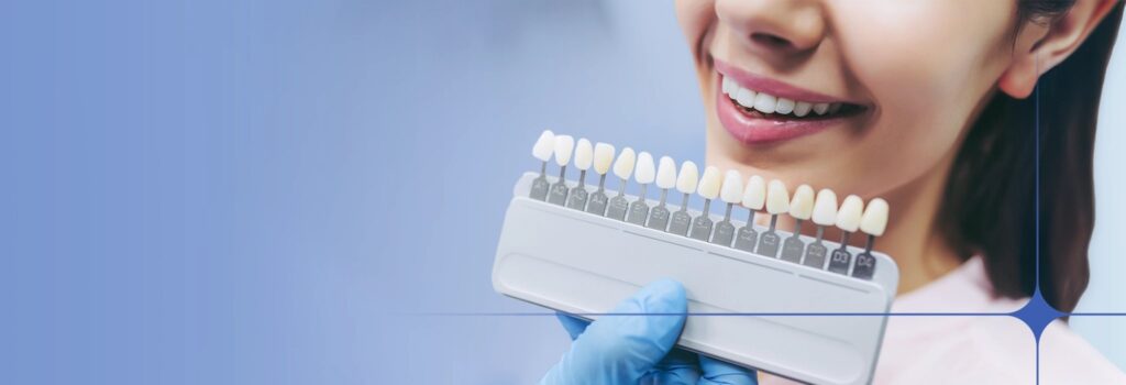 veneers vs ceramic veneers