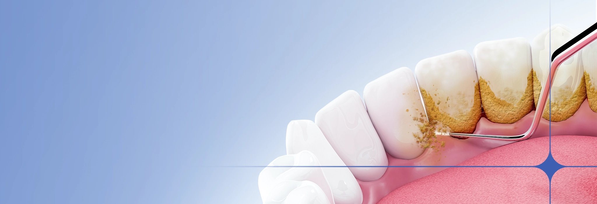 ทำสปาฟัน ต่างกับขูดหินปูนไหม