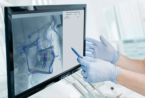 nemoceph-plantillas-e-informes