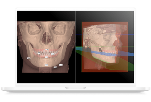 nemofab-ortho-analisis-cefalometrico-3D