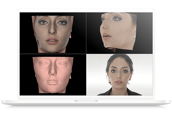 nemofab-ortho-mapeo-de-foto-2D-a-la-tomografia