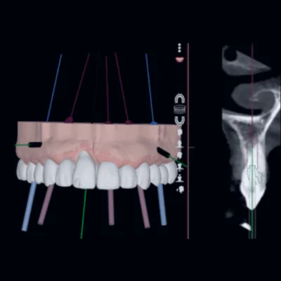 วิเคราะห์และวางแผน